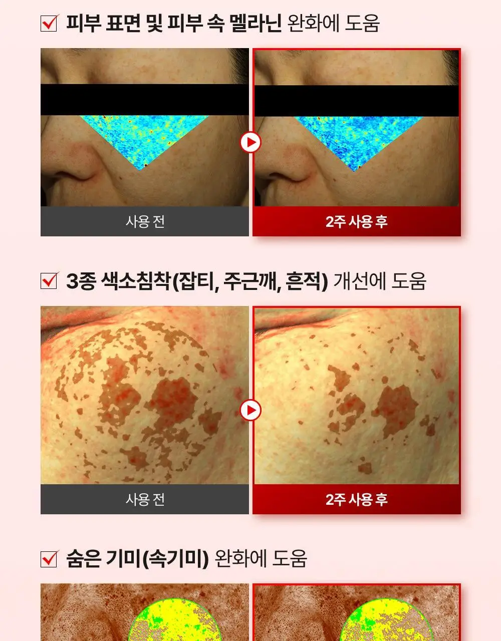 [기미잡티] 메디필 멜라논엑스 앰플 RX 30ml 상세페이지 30